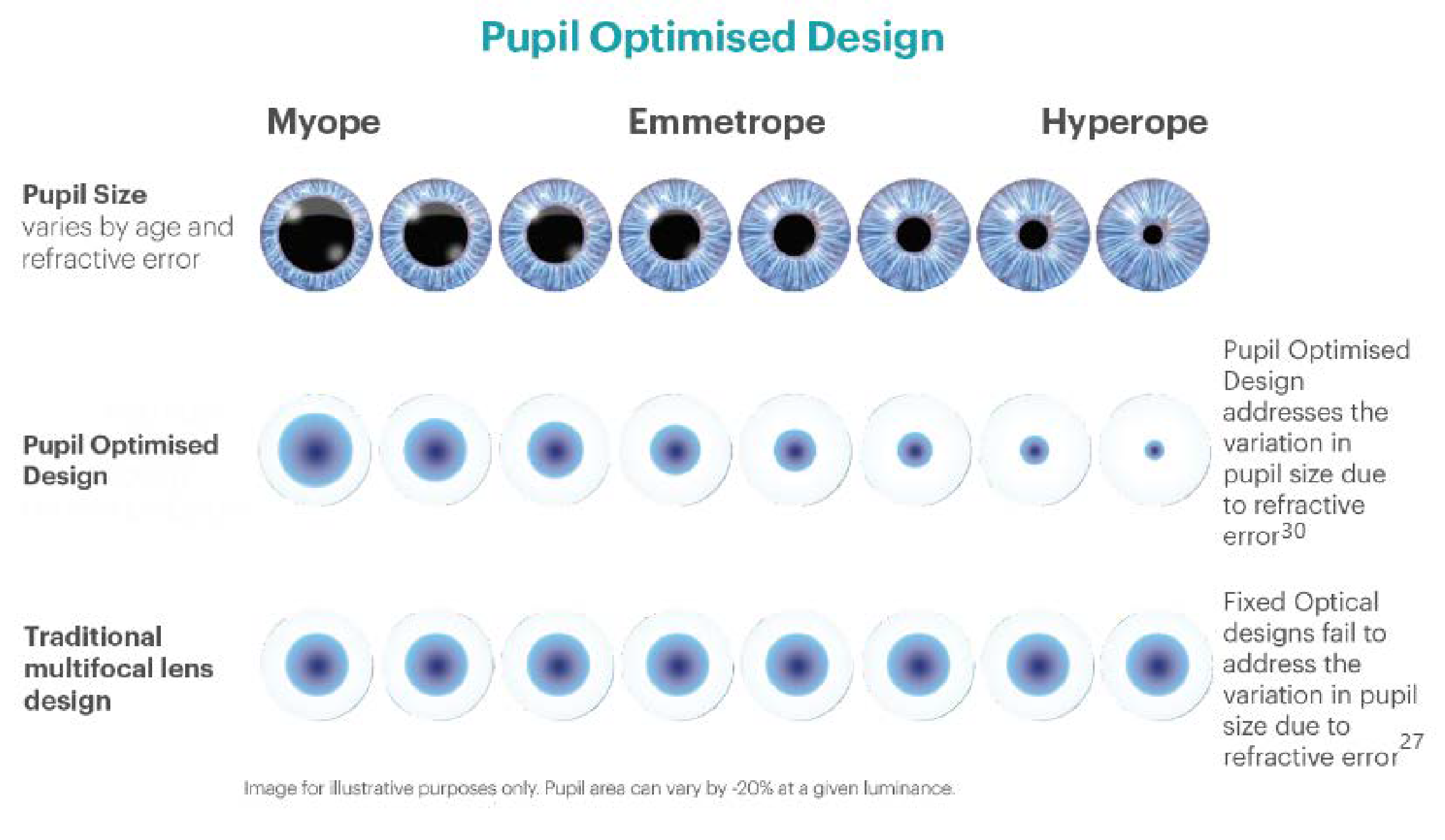 Figure 4 Illustration of how pupil size optimization can improve design match