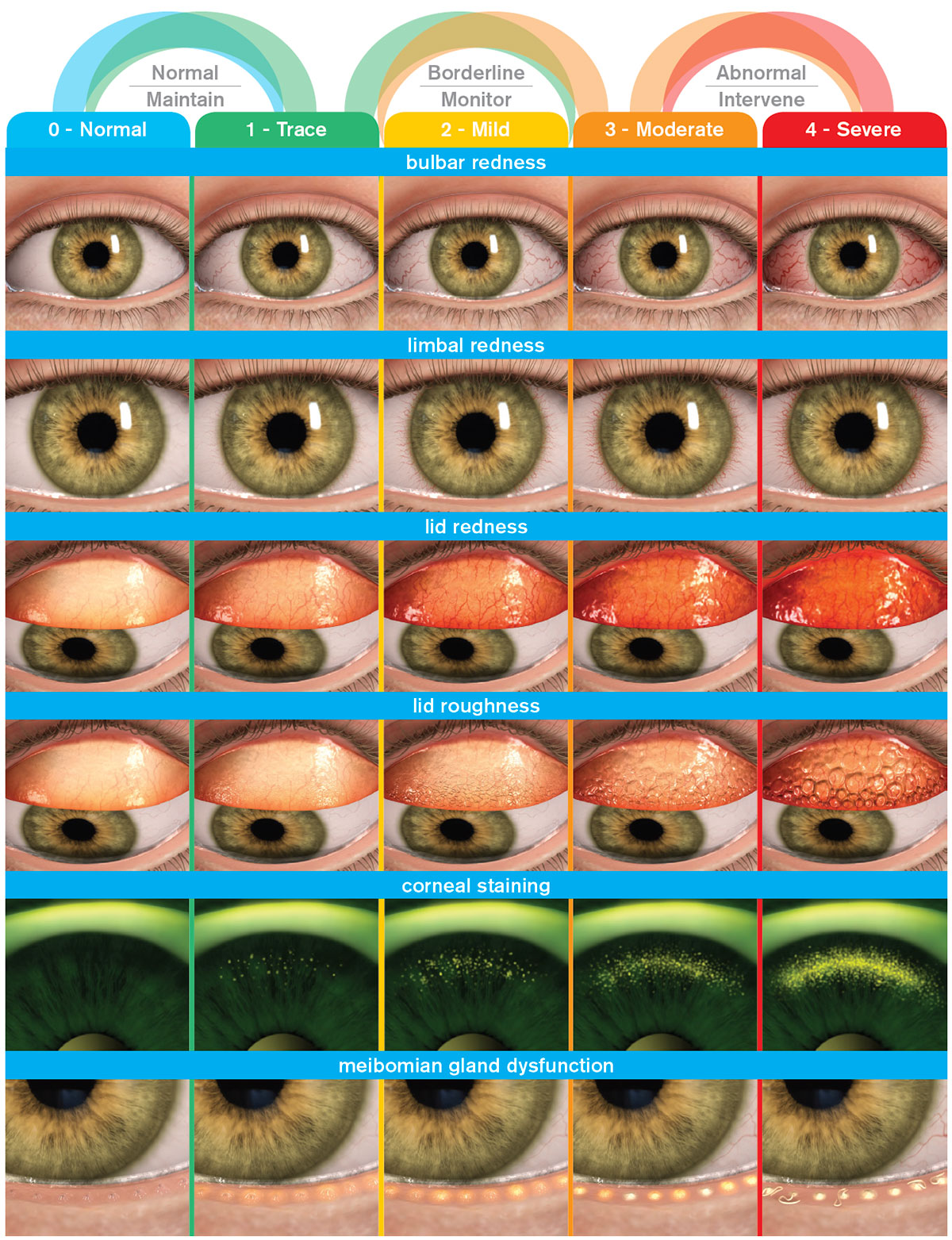 Grading scales of clinical signs